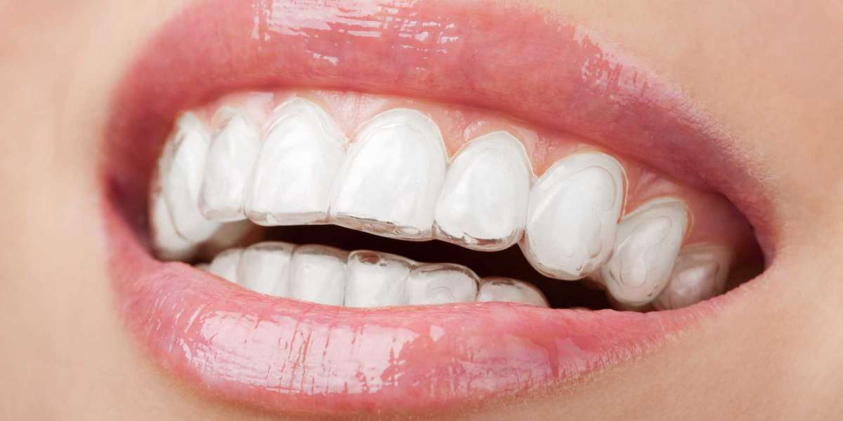 World of Teeth Braces at Amma Naana Dental Clinic
